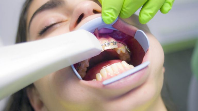 Czy należy obawiać się wizyty u ortodonty?